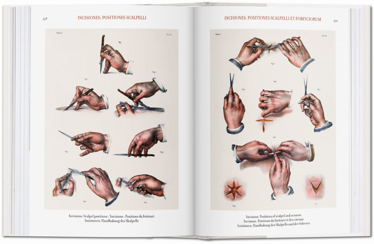 Bourgery. Atlas der menschlichen Anatomie und der Chirurgie